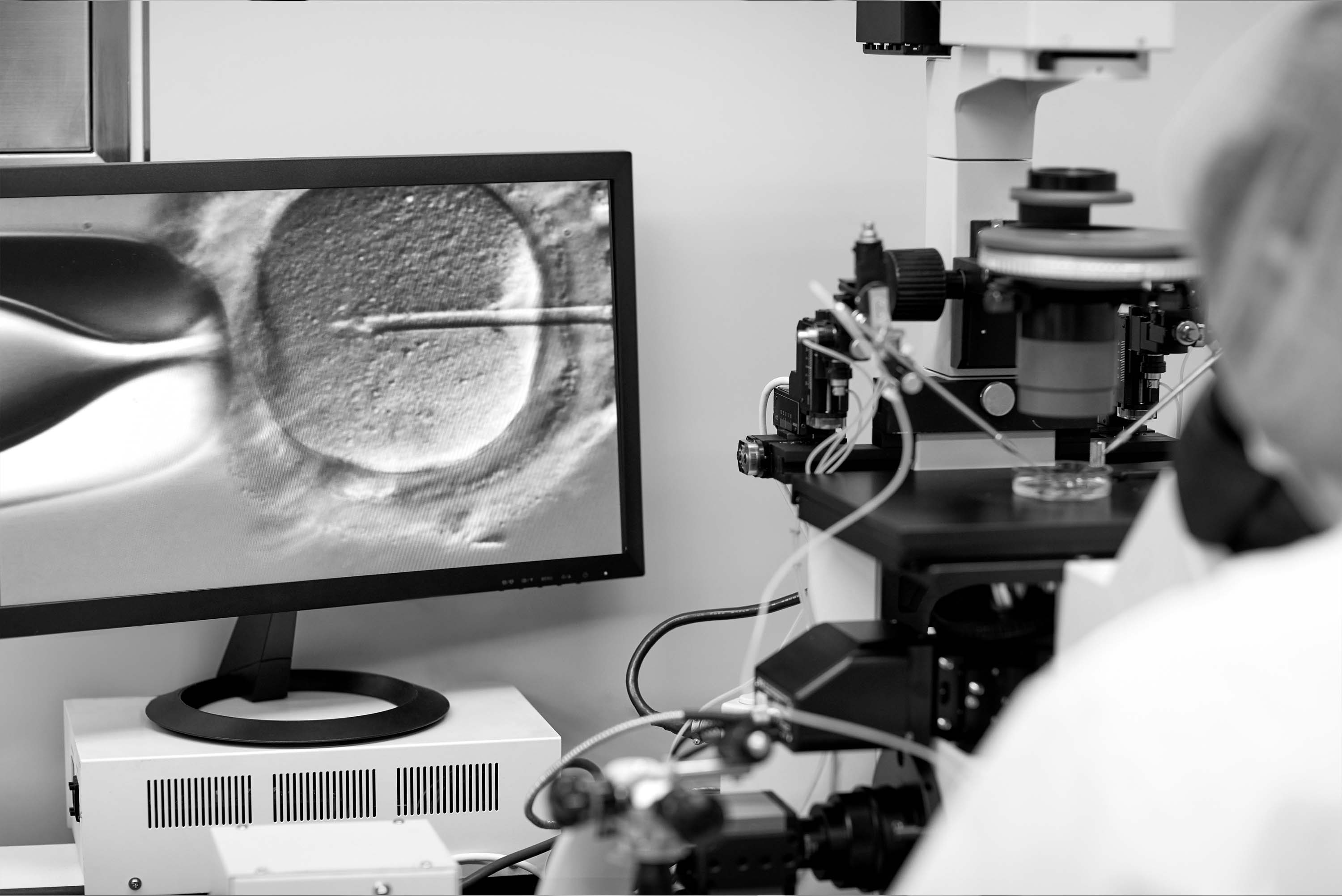 black and white image of an IVF fertilization happening